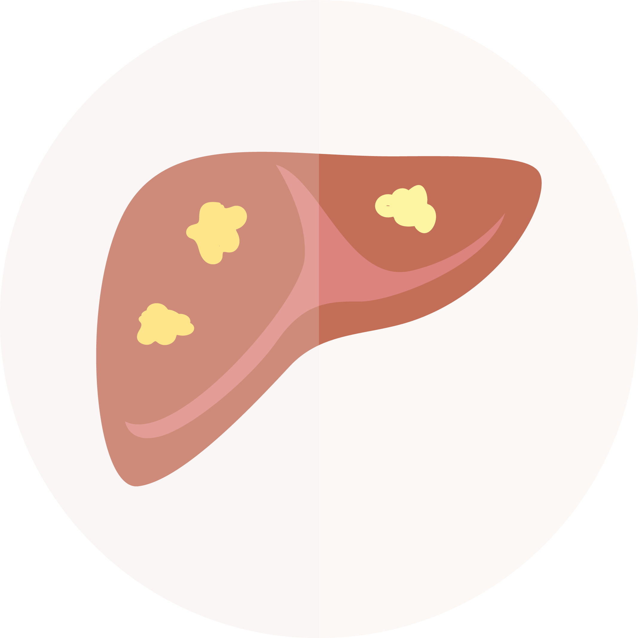 drawing: NAFLD liver